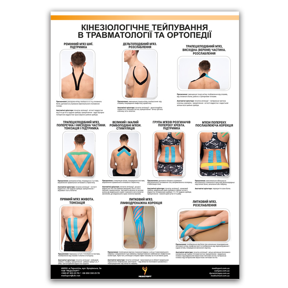 Плакат "Кинезиотейпирование в травматологии и ортопедии" Медіспорт