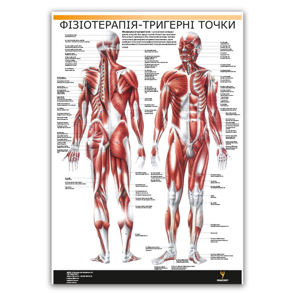 Плакат "Физиотерапия-тригерные точки" Медіспорт