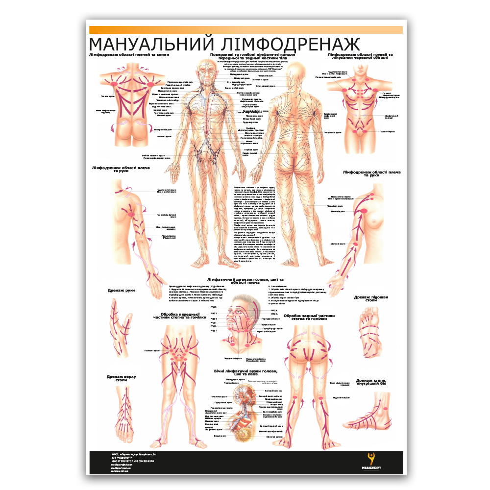 Плакат "Мануальный лимфодренаж" Медіспорт
